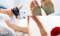 Topuk Ağrısı İleri Evrelerinde Cerrahi Seçenekler